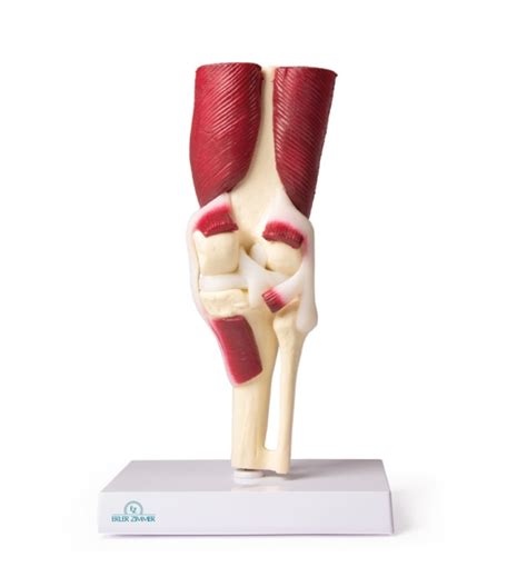 vizualizácia svalových skupín okolo kolenného kĺbu