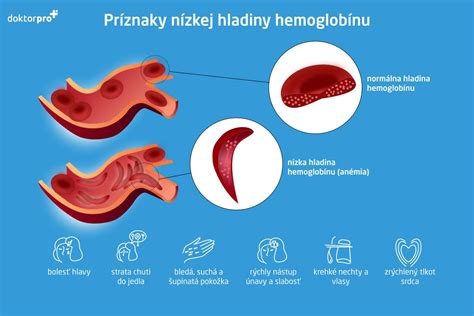 Infografika znázorňujúca bežné príznaky nízkej hladiny testosterónu u mužov.