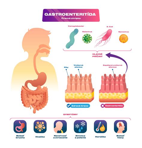 Infografika zobrazujúca potraviny prospešné a škodlivé pre trávenie a črevnú mikroflóru