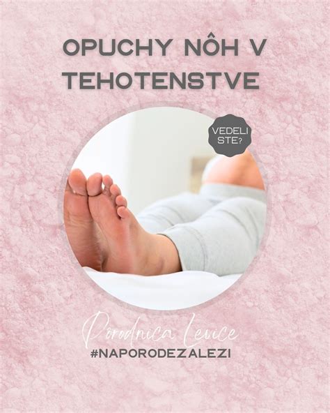 Ilustrácia znázorňujúca rôzne príčiny opuchov nôh (cievne, lymfatické, systémové)