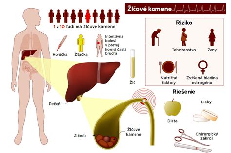 Infografika znázorňujúca bežné príznaky spomaleného metabolizmu