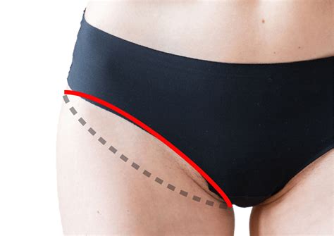 žena merajúca obvod stehna