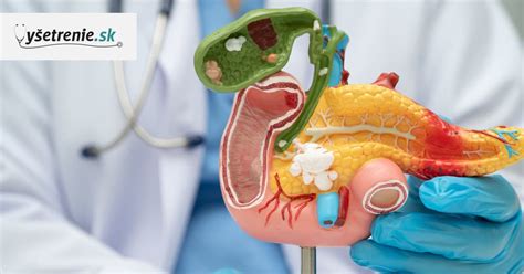 Ilustračná schéma ľudského tráviaceho systému s vyznačeným pankreasom