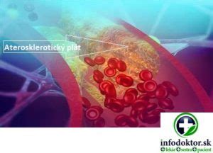 Vizualizácia ľudského metabolizmu tukov