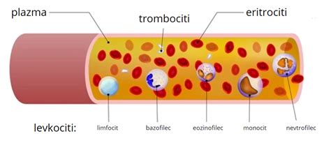 Obrázok znázorňujúci orgány postihnuté hemochromatózou.